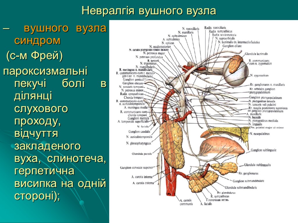 Невралгія вушного вузла – вушного вузла синдром (с-м Фрей) пароксизмальні пекучі болі в ділянці